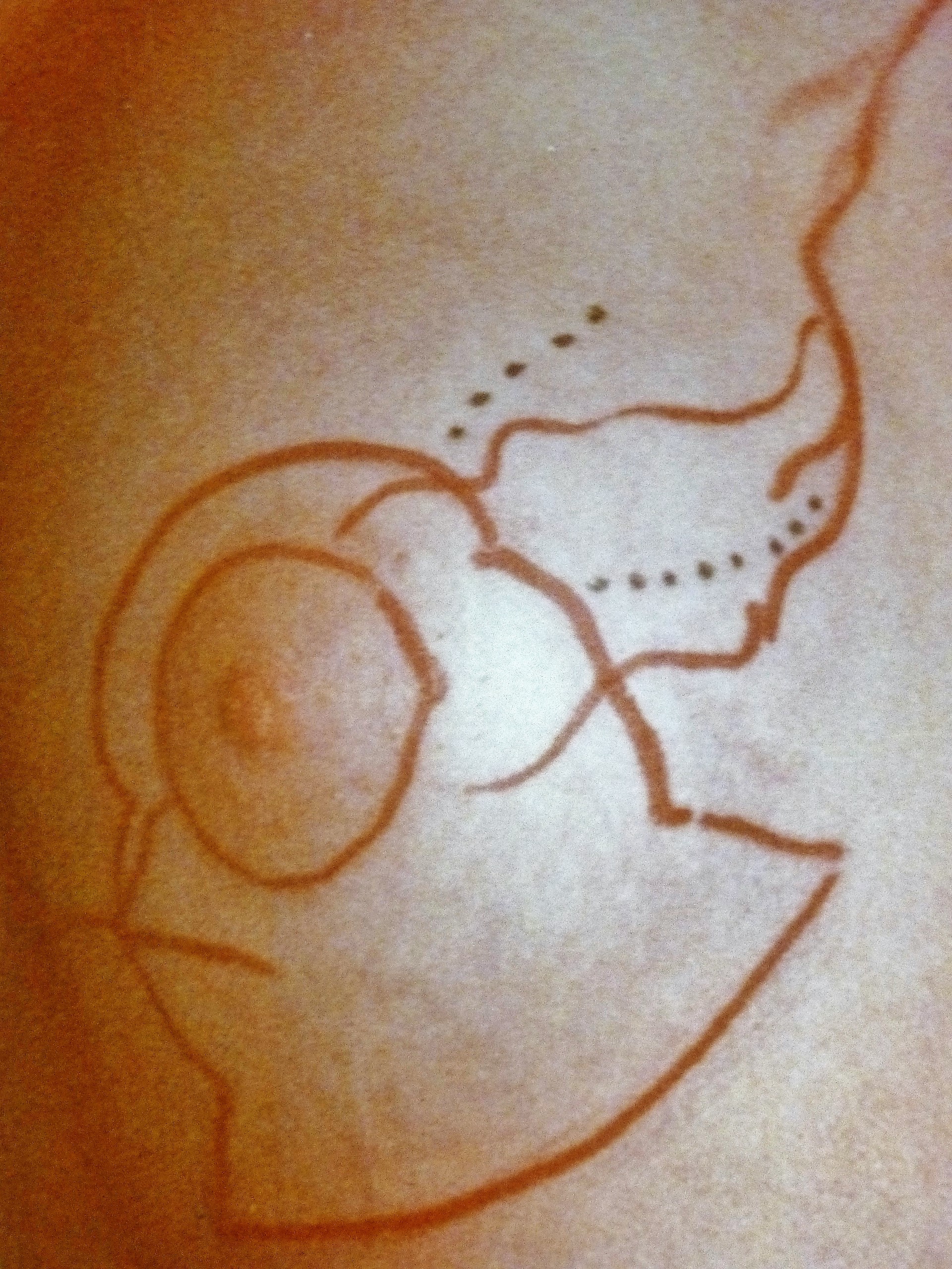 le plan du prélèvement de glande et de graisse avec le dessin des vaisseaux à préléver du côté gauche